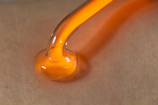 Medical procedure darsonvalization