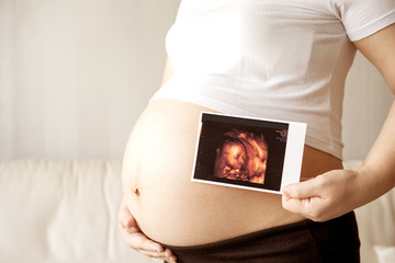 Pregnant woman with ultrasound scan picture