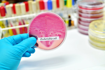 Bacteria colony of Escherichia coli (E.coli) in culture media plate