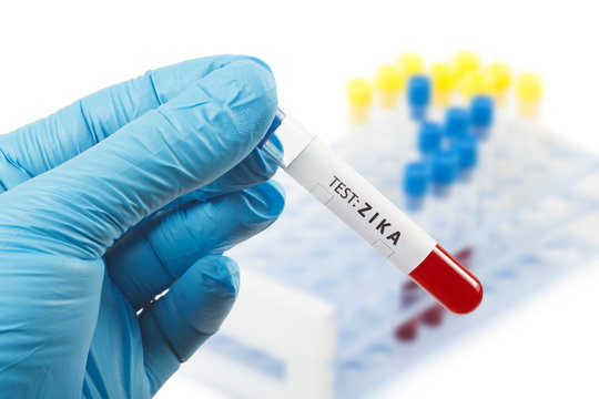 Zika. Blood test