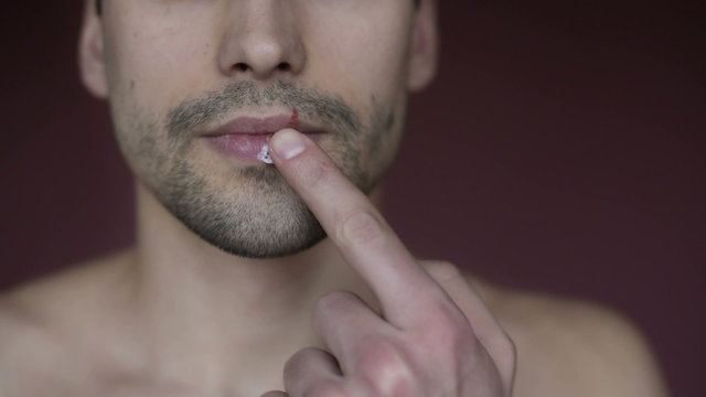 The male herpes on the lip. Using an ointment