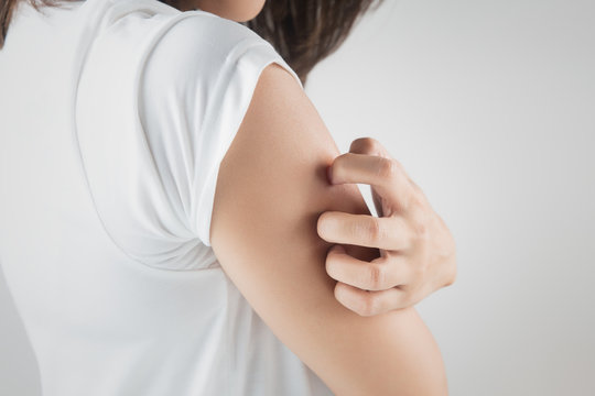 Woman scratching her arm.