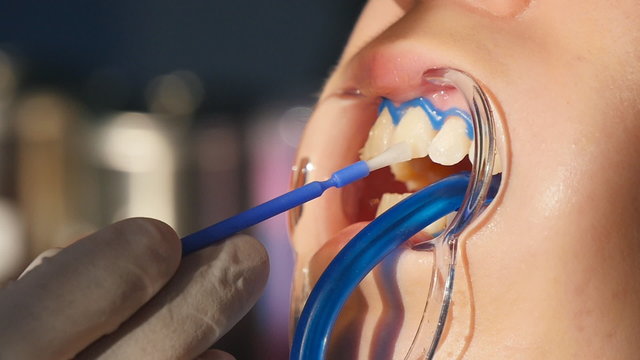 Whitening teeth closeup in slow motion