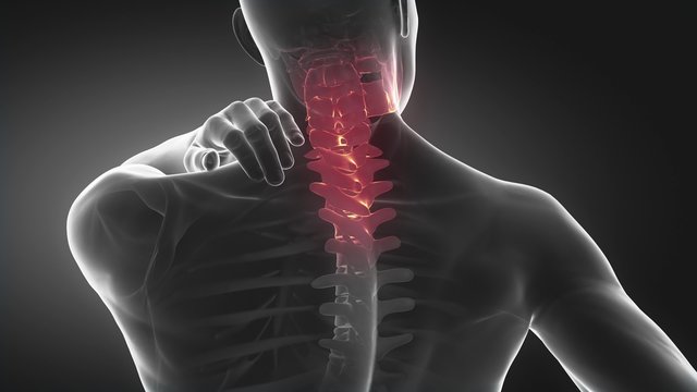 Spine injury pain in sacral and cervical region concept