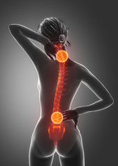Spine injury pain in sacral and cervical region concept - obrazy, fototapety, plakaty