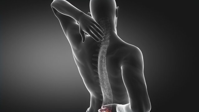 Pain in spine proceed to neck region