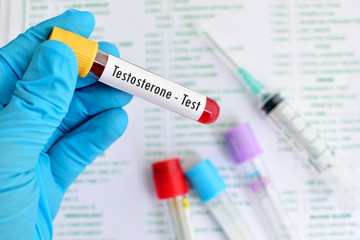 Blood sample for testosterone hormone test - obrazy, fototapety, plakaty