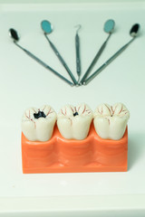 teeth model and dental instruments