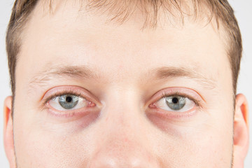 Naklejka premium Man's tired eyes