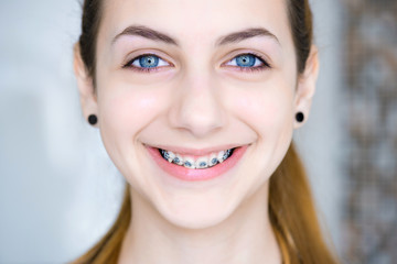 Naklejka premium Teeth with braces.
