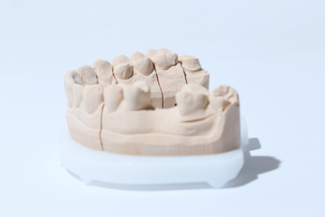 Zahnabdruck © janmalburg