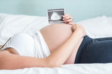 Obraz na płótnie Canvas Pregnant woman showing an ultrasound picture
