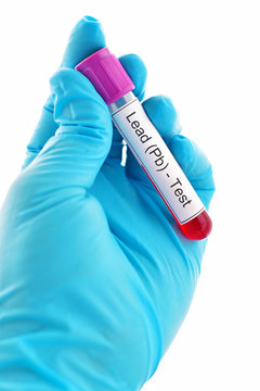 Blood for lead metal test
