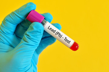 Obraz premium Lead test