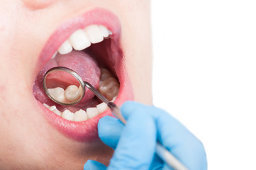 Close-up of woman patient with open mouth at the dentist