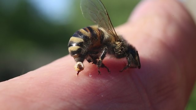 Bee stings a man.
Abandoned bee sting in the human body makes movements, releasing a poison vial.