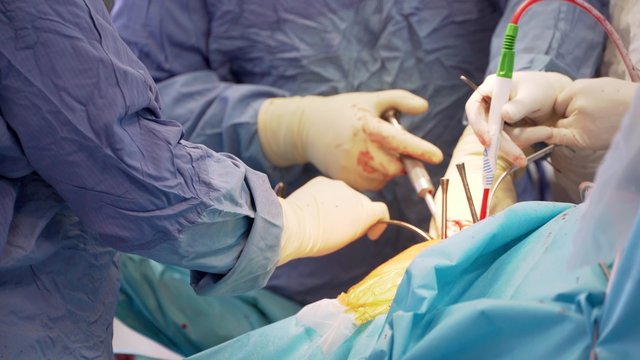 Orthopedic surgeon preparing for proximal tibia osteotomy 