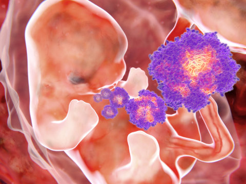 Zika-Virus, Gefahr f&uuml;r Embryos
