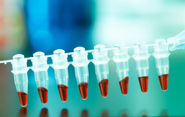 pcr analysis dna profiling