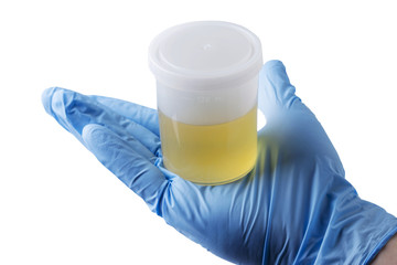 jar of urine