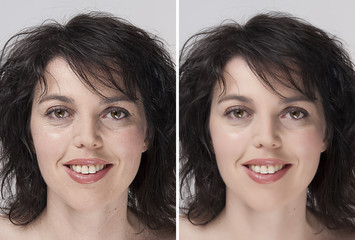 before - after rejuvenation