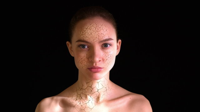 Dry Skin. Girl with dry skin on the face and neck turns into a beautiful woman with perfect complexion. 4k - Ultra HD.