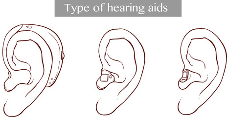  vector illustration of a Type of hearing aids