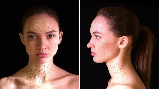 Dry Skin. Girl with dry skin on the face and neck turns into a beautiful woman with perfect complexion. 4k - Ultra HD.