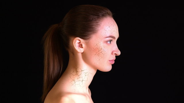 Dry Skin. Girl with dry skin on the face and neck turns into a beautiful woman with perfect complexion. 4k - Ultra HD.