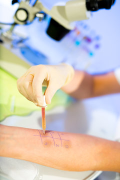 Allergy - skin prick tests