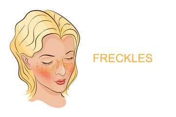a face with freckles young women