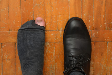 male feet in one Shoe and torn sock