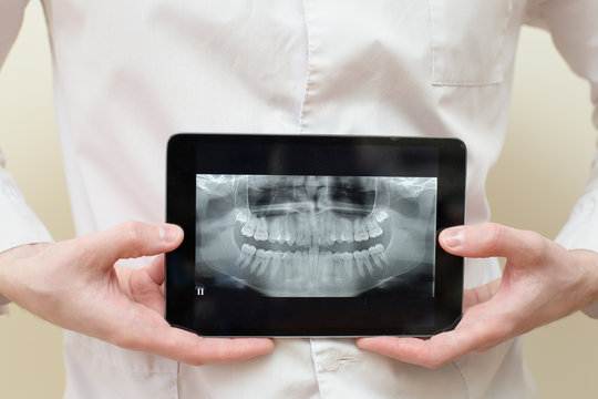 x ray tablet dental