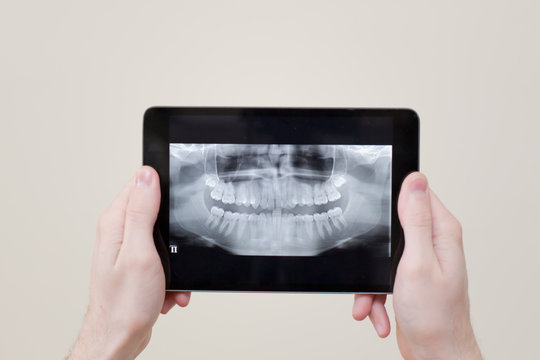 x ray tablet dental