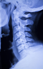 Skull neck spine shoulders xray scan