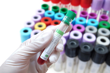 Lithium Heparin blood collection tube,with green plastic stopper