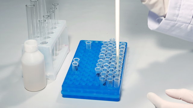 Lab technician scientist performs medical clinic chemical analysis and diagnostics using test tube phial and pipette. 4K UHD video footage.