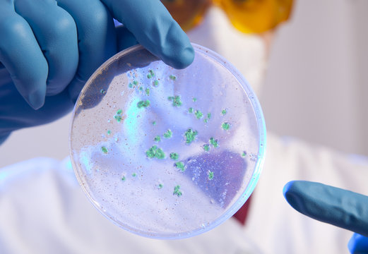 Scientist holding virus cells