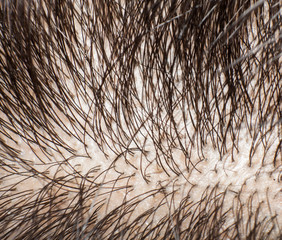 Closeup head with hair and scalp