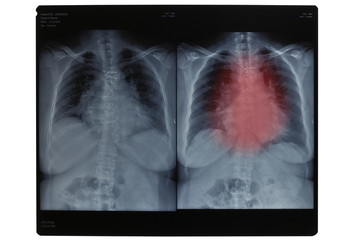 x-ray imaging, disease