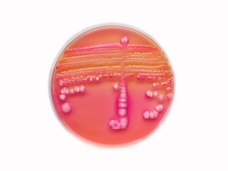 Colony of bacteria in culture medium plate
