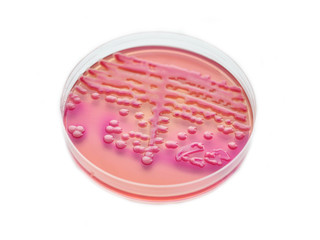 Obraz na płótnie Canvas Colony of bacteria in culture medium plate 