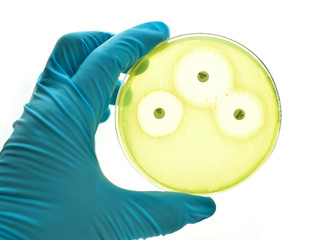 Antimicrobial susceptibility testing in culture medium plate

