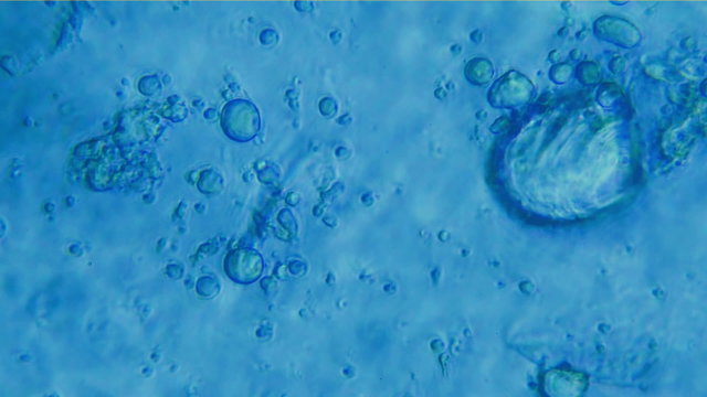 Yeast Bacteria Under Microscope View