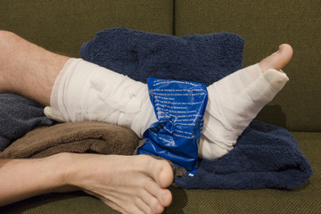 Icing a Broken, Fractured, or Sprained Ankle 