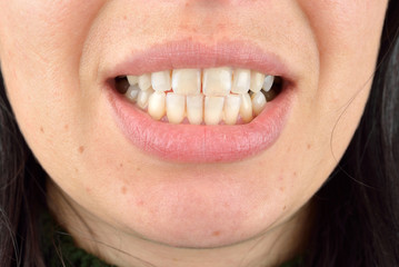 Close up of healthy teeth of young woman. Dental health care. Hy