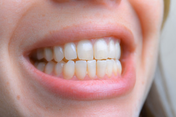 Close up of healthy teeth of young woman. Dental health care. Hy