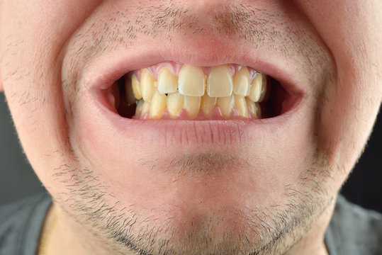 Detailed image of man showing his teeth. Dental health care. Hyg