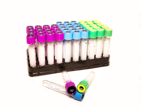 Tubos de anal&iacute;tica en fondo blanco