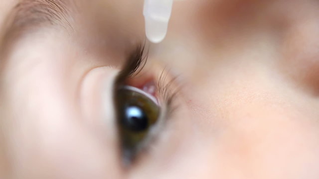 Close up of an eye of a child receiving medicine, eye drop